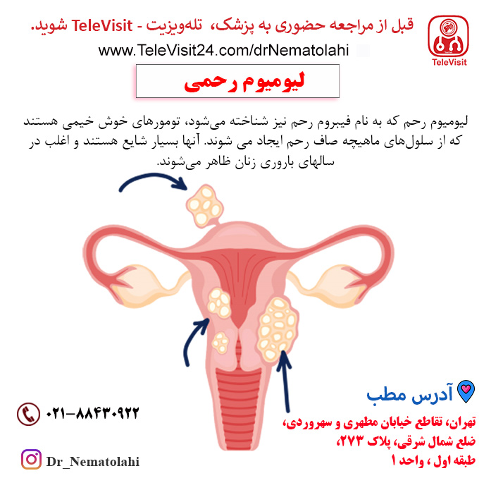 لیومیوم رحمی