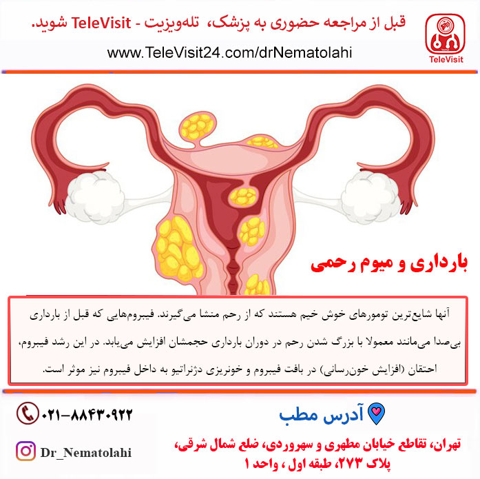 بارداری و میوم رحمی