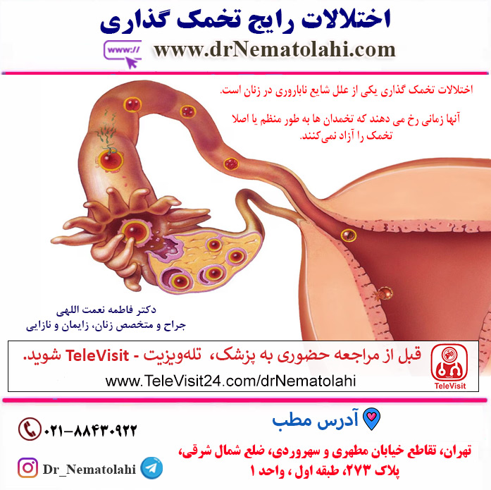 اختلالات رایج تخمک گذاری