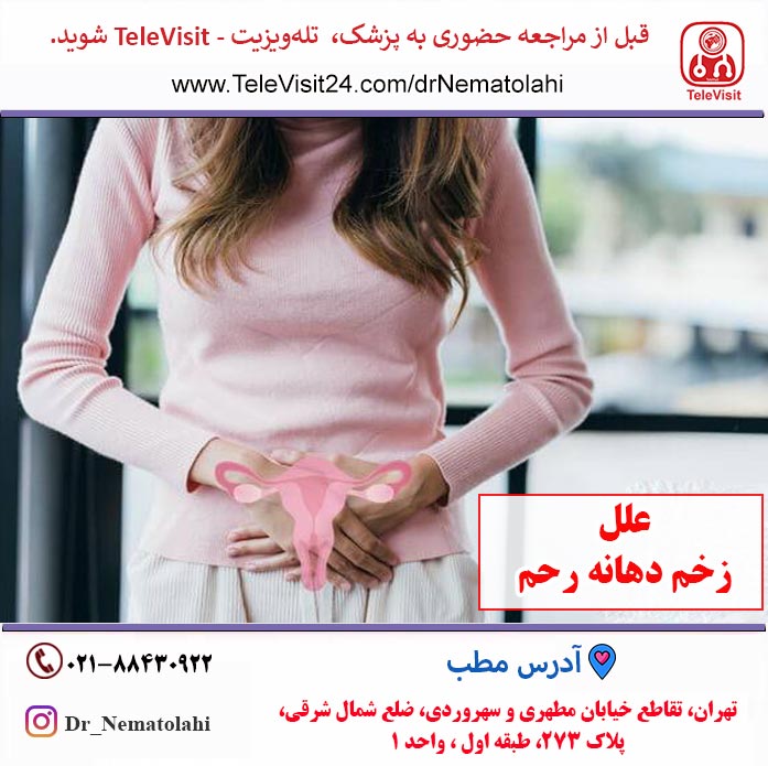 علل زخم دهانه رحم در زنان